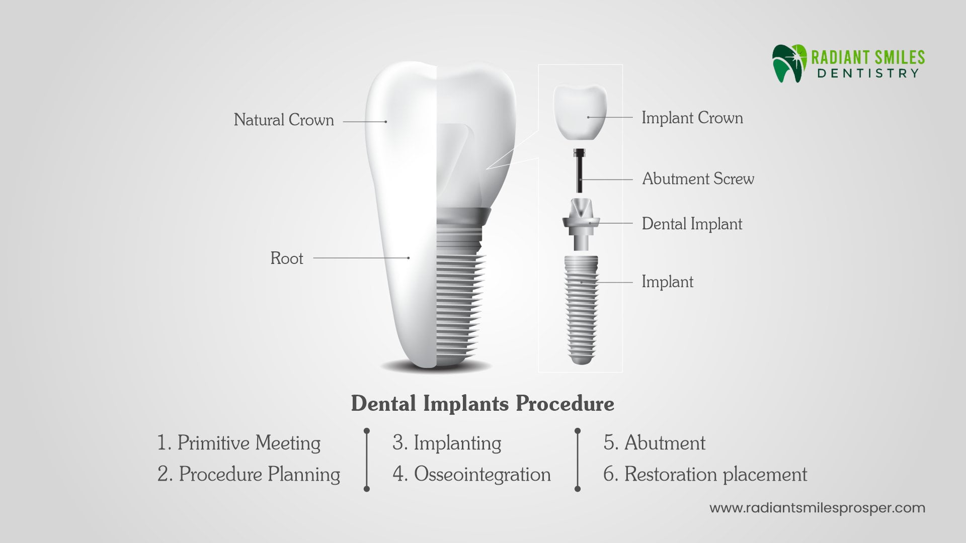 Understanding Dental Implants: A Comprehensive Overview for Patients