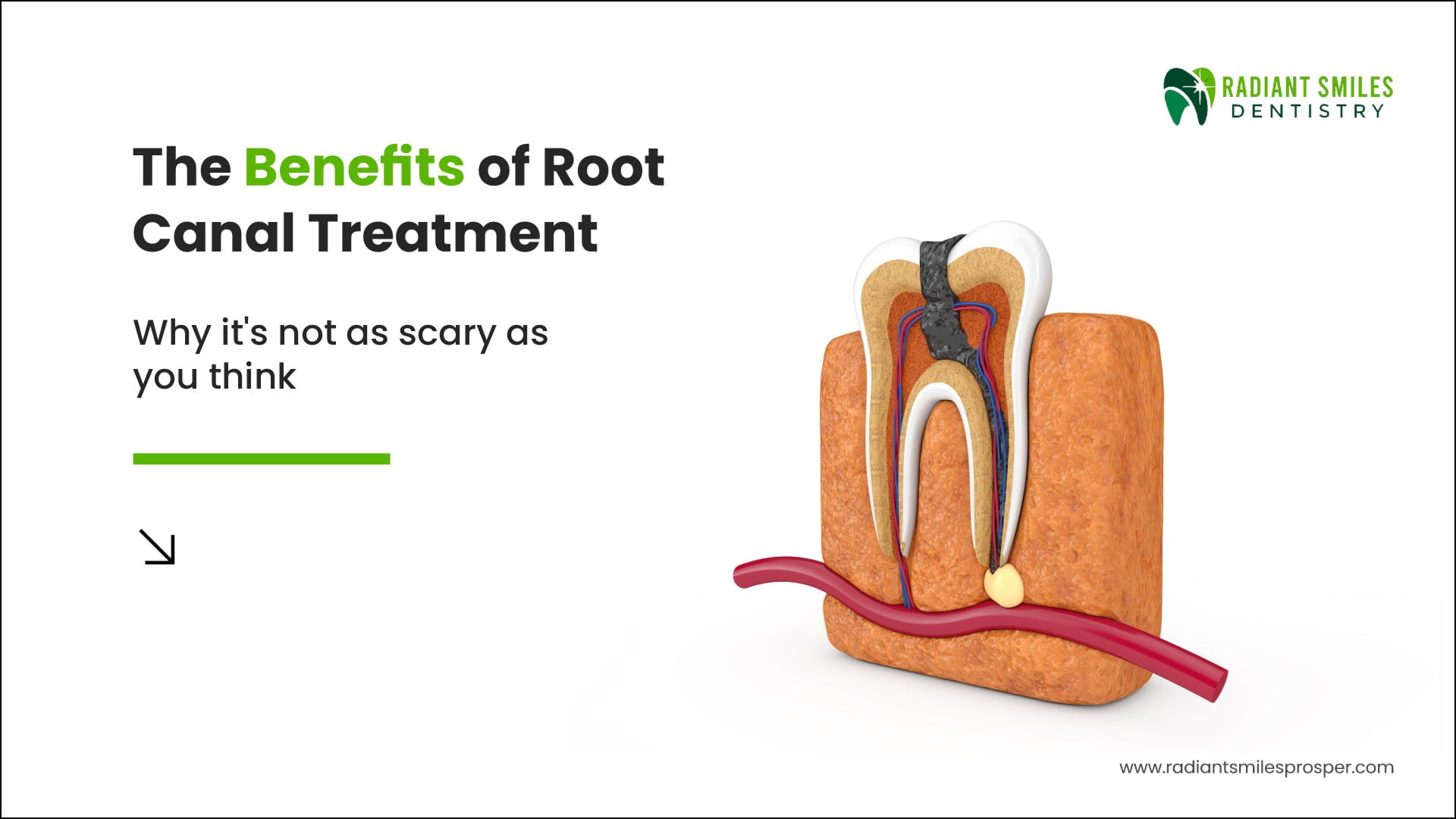 The Benefits of Root Canal Treatment: Why It’s Not as Scary as You Think