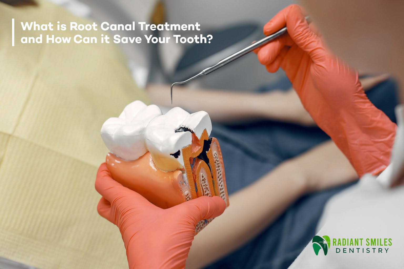 What is Root Canal Treatment and How Can it Save Your Tooth?