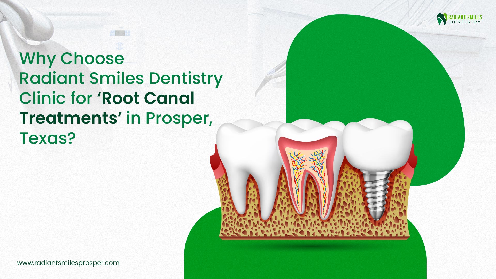 Why Choose Radiant Smiles Dentistry Clinic for ‘Root Canal Treatments’ in Prosper, Texas?