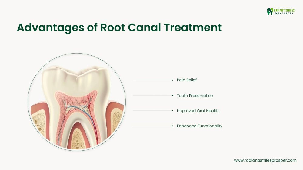 advantages of Root Canal Treatment