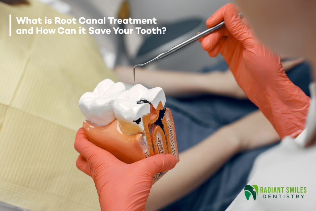 Root Canal Treatment and How Can it Save Your Tooth