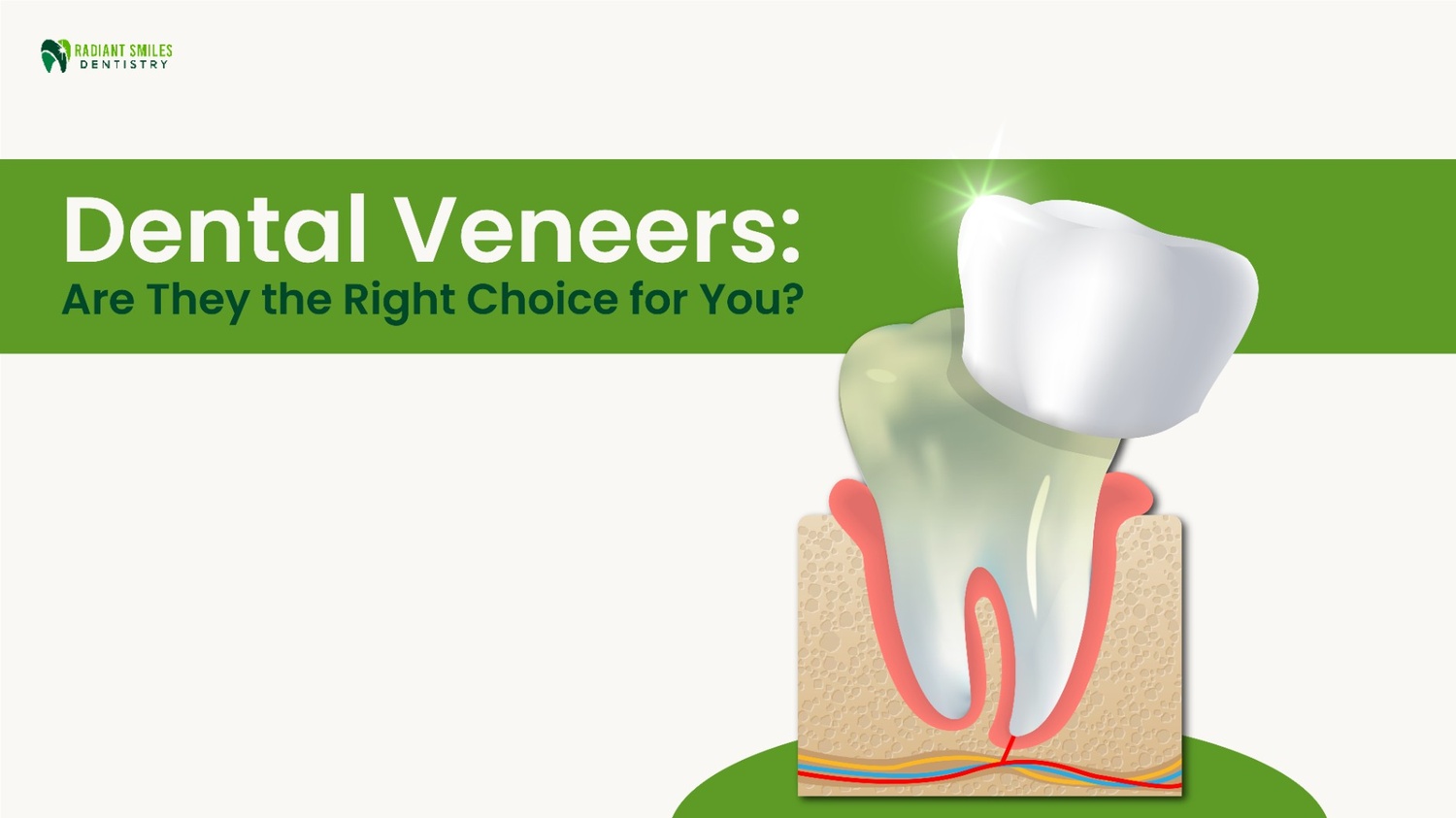 are dental veneers right for me