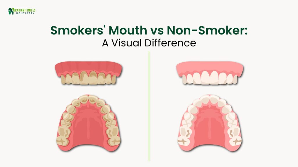 non smoker vs smoker’s mouth