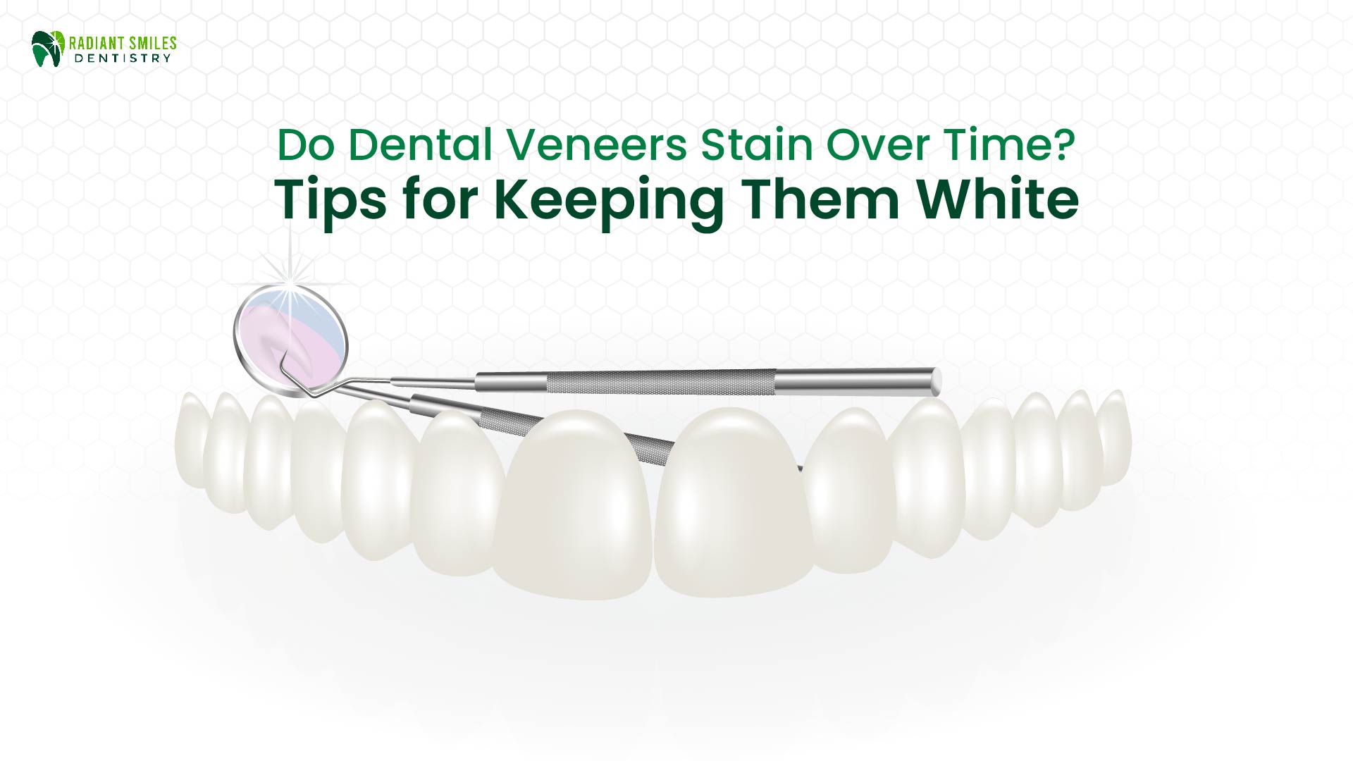 do dental veneers stain and how to keep veneers white