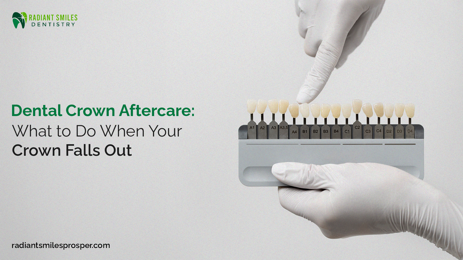 Dental Crown Aftercare: What to Do When Your Crown Falls Out