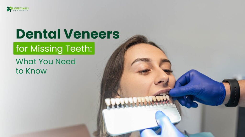 Dental veneers for missing teeth explained by cosmetic dentist in Prosper TX