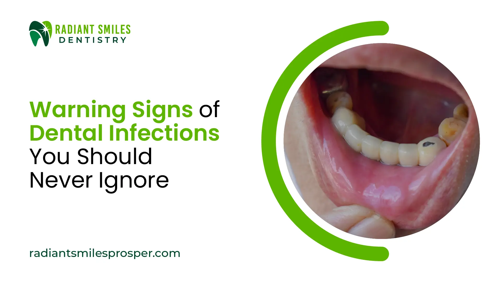 Warning Signs of Oral Teeth Infections You Should Never Ignore